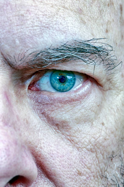 istock Relaxed Senior Man Single Eye Close-up Portrait 1134900923