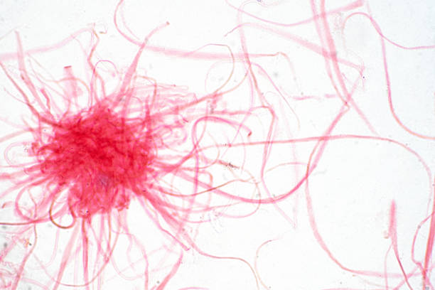 istock Cancer Cell in human under the microscope view. Medical science background concept. 1134908979