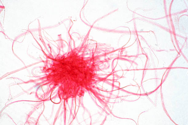 istock Cancer Cell in human under the microscope view. Medical science background concept. 1134909029