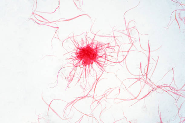 istock Cancer Cell in human under the microscope view. Medical science background concept. 1134909044