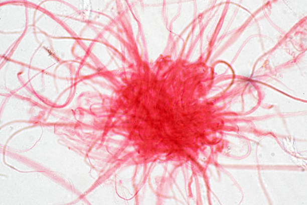 istock Cancer Cell in human under the microscope view. Medical science background concept. 1134909050