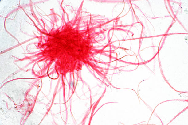 istock Cancer Cell in human under the microscope view. Medical science background concept. 1134909081