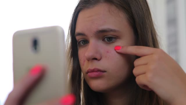 Young girl looking at her front camera on mobile phone, and she's sad about her acne problem