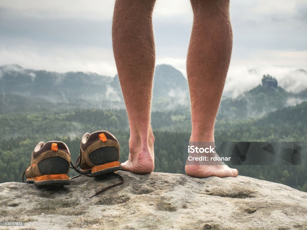 Close up on Blister on foot of a male. Hurt hikers legs without shoes. Close up on Blister on foot of a male. Hurt hikers legs without shoes. Misty morning fall nature. Outdoor activities Blister Stock Photo