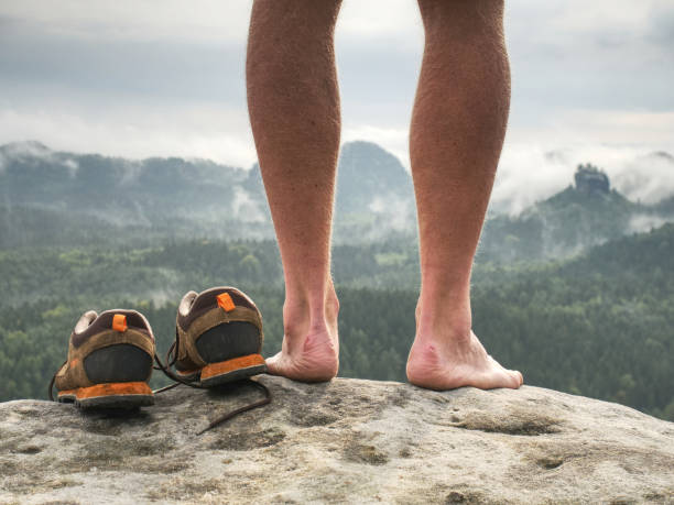 Close up on Blister on foot of a male. Hurt hikers legs without shoes. stock photo