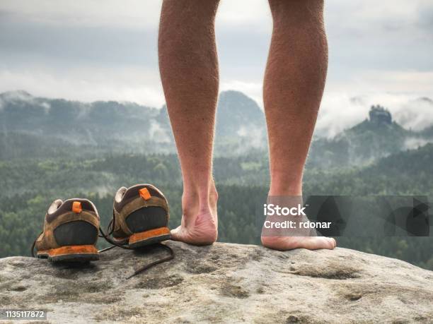 Close Up On Blister On Foot Of A Male Hurt Hikers Legs Without Shoes Stock Photo - Download Image Now