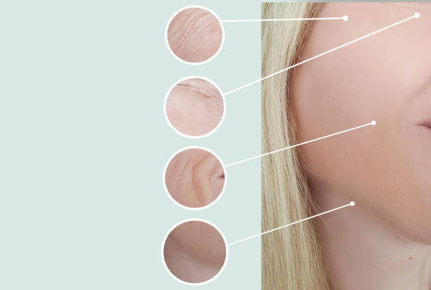 istock female wrinkles before and after pigmentation 1135126419