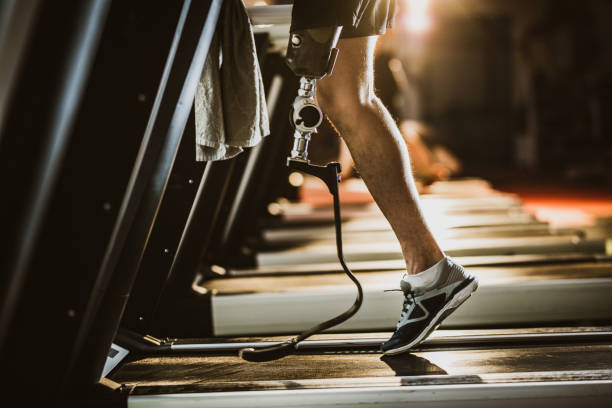 istock Unrecognizable amputee exercising on treadmill in a gym. 1135269046