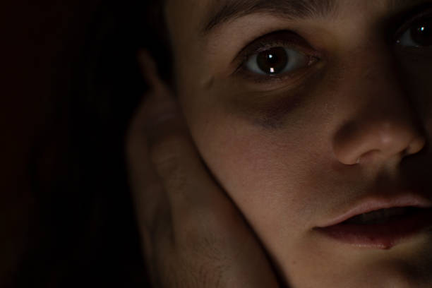 istock Woman with a  black eye 1135280717