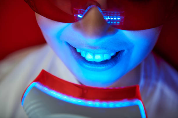 istock Face of young lady on tooth bleaching 1135320805
