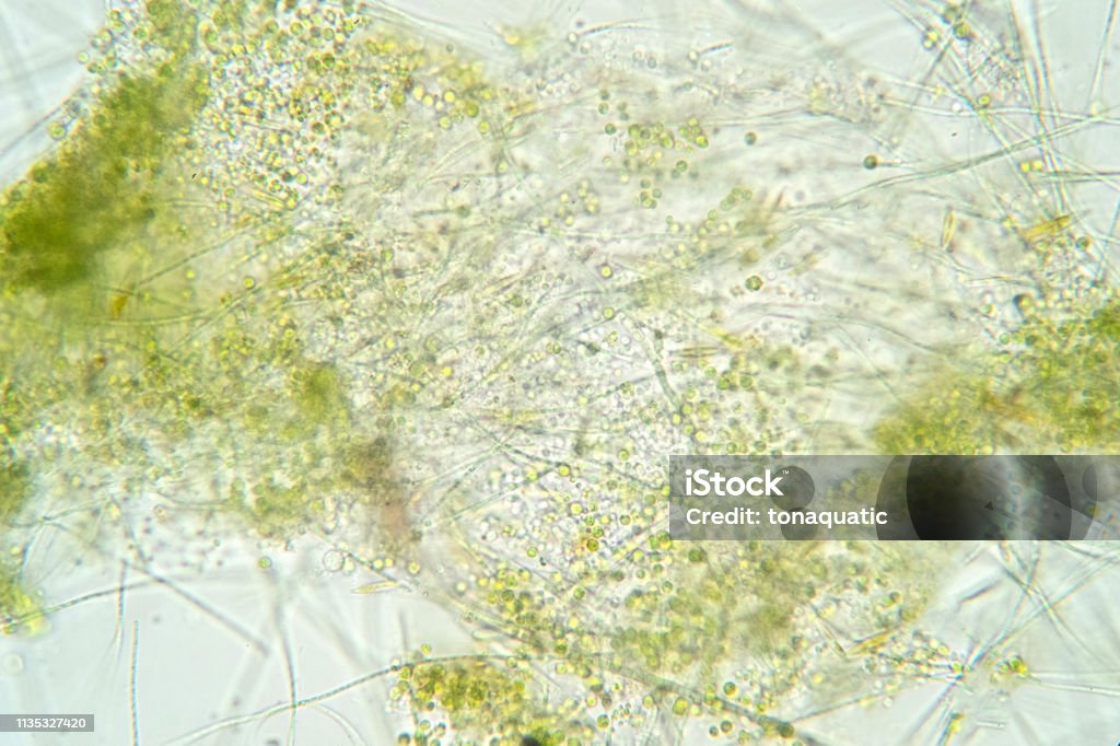 Alge Thread Filamentous Algae Are Single Algae Cells That Form Long Visible Chains ...