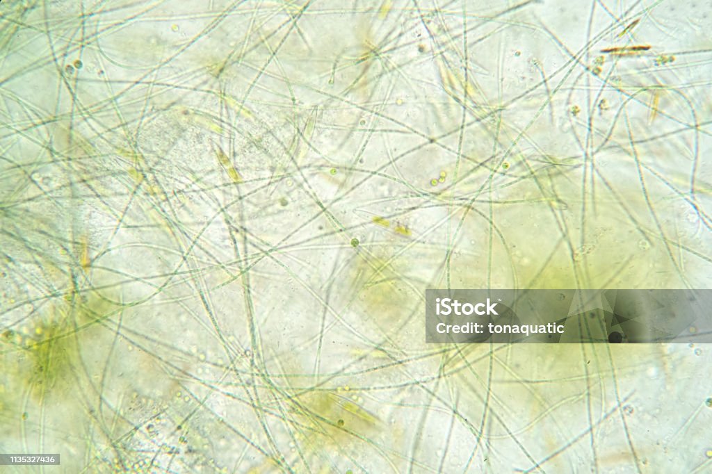 Alge Thread Filamentous Algae Are Single Algae Cells That Form Long Visible Chains ...