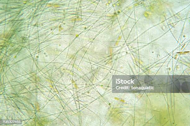 Filamentous Examples Filamentous Algae Are Single Algae Cells That Form Long Visible Chains ...