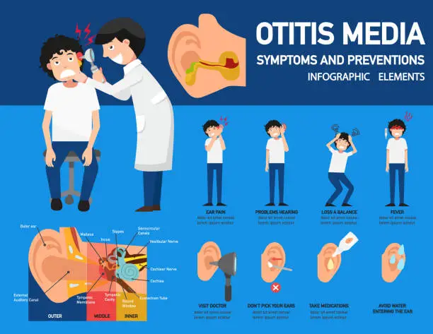 Vector illustration of Otitis media symptoms and preventions infographic