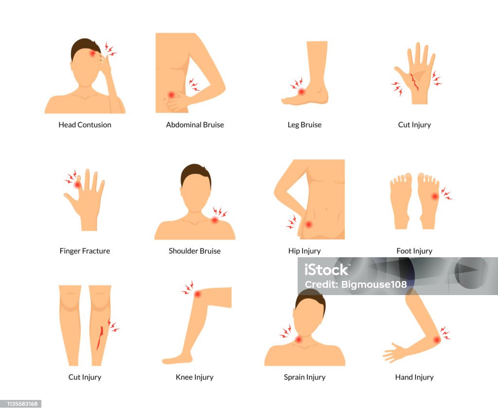 Ilustración de Dibujos Animados Color Dolor Cuerpo Humano Conjunto Vector y más Vectores Libres de Derechos de Pierna - iStock Ilustración de Dibujos Animados Color Dolor Cuerpo Humano Conjunto Vector y más Vectores Libres de Derechos de Pierna - iStock