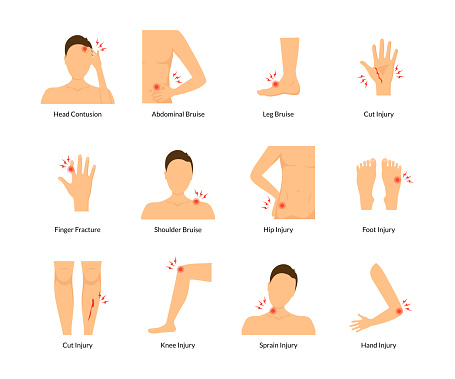 Cartoon Color Pain Human Body Set Include of Hand, Elbow, Shoulder, Neck, Knee and Leg Flat Design. Vector illustration