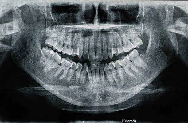 ヒト歯科 x 線検査 - 歯 写真 ストックフォトと画像