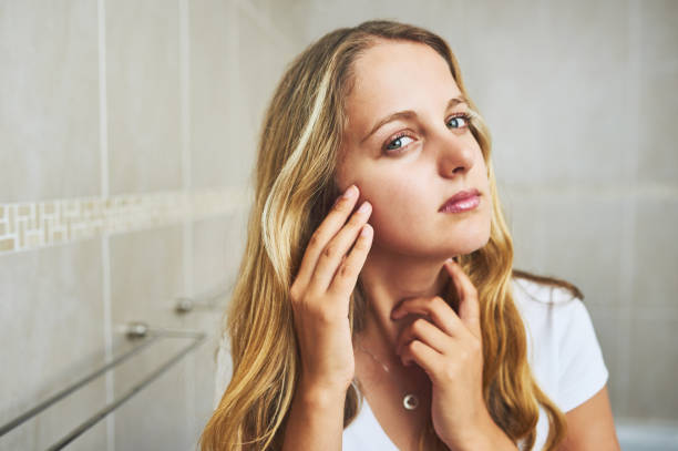 istock My skin looks all cleared up now 1135787623