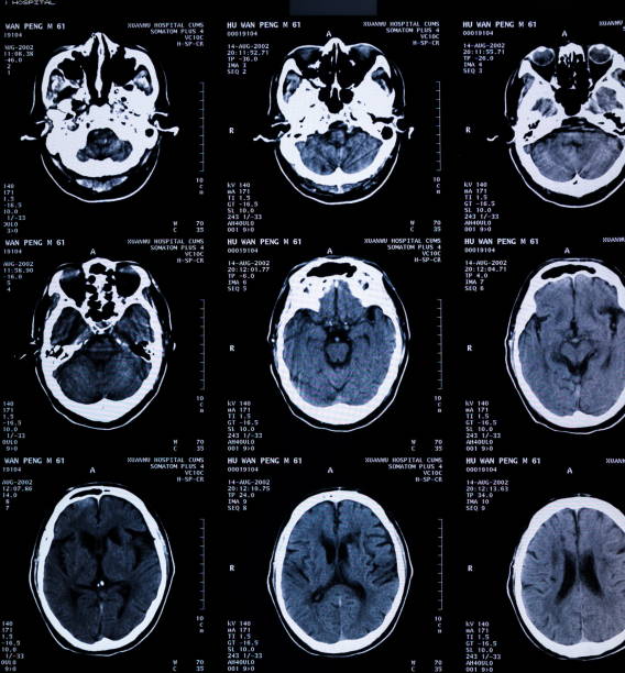 mri skan ludzkiej głowy flim - mri scan cat scan machine x ray brain zdjęcia i obrazy z banku zdjęć