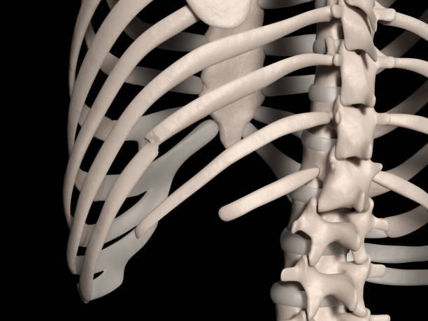 10 번째 갈비뼈의 골절 (거짓 갈비) - false rib 뉴스 사진 이미지