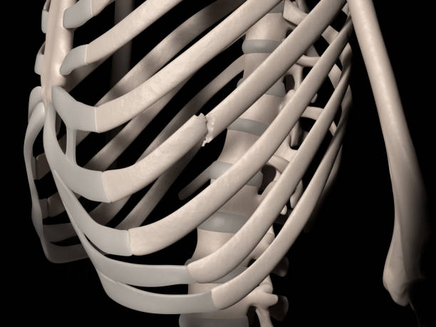 第7肋骨の骨折 (真リブ) - rib cage ストックフォトと画像