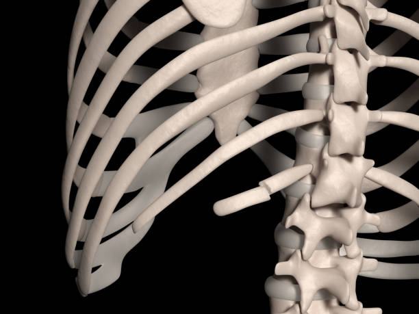 12 번째 갈비뼈의 골절 (떠 있는 갈비뼈) - false rib 뉴스 사진 이미지