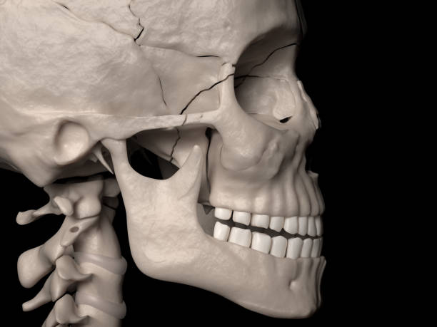 LeFort complex fracture, class III (facial fracture) Digital medical illustration depicting a class III LeFort complex fracture (facial fracture). Lateral (side) view. sphenoid bone stock pictures, royalty-free photos & images