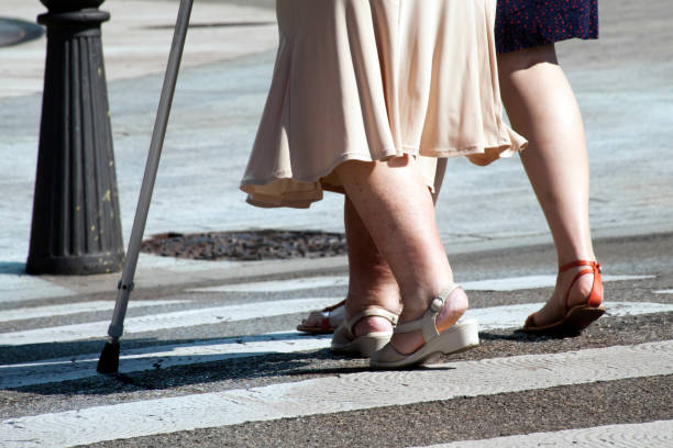 two women walking on zebra crossing, one with crutches. - garment fragility women skirt imagens e fotografias de stock