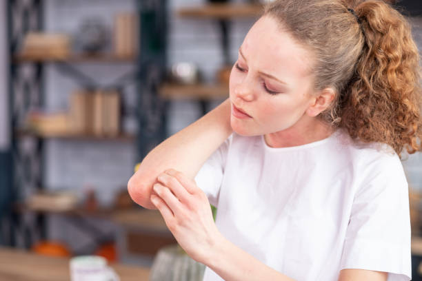istock Distressed unhappy young lady rubbing her spotted elbow 1136200332