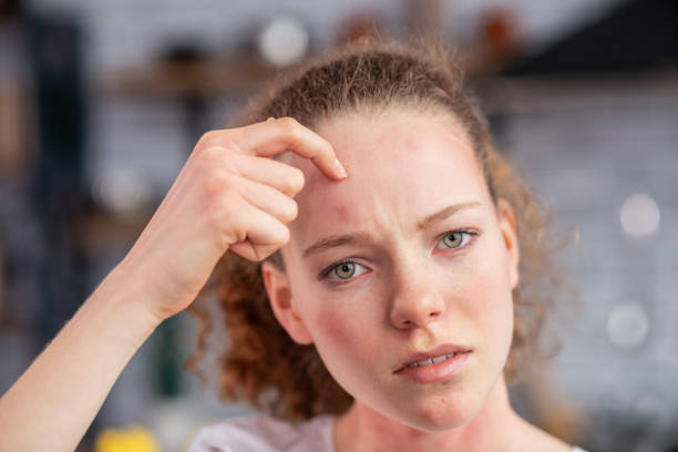istock Distressed long-haired woman pointing on allergic spot 1136200334