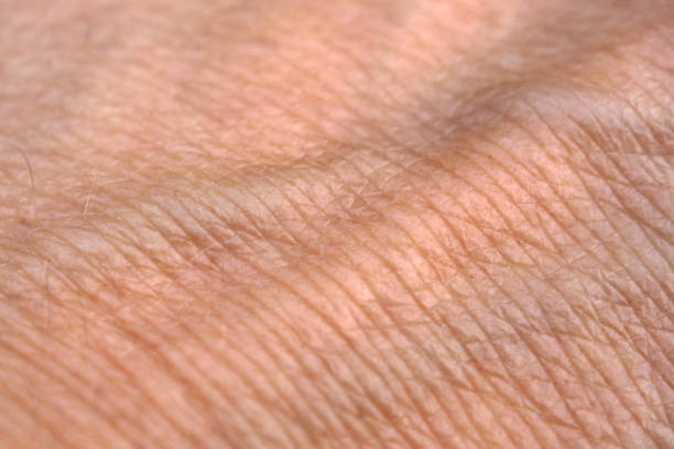 istock Hand skin with swollen Veins. 1136466288
