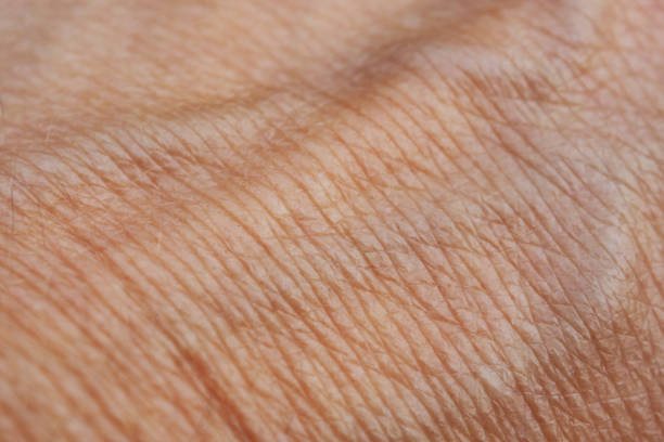 istock Hand skin with swollen Veins. 1136466396