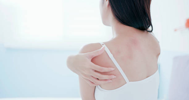 istock woman scratching shoulder and neck 1136545659