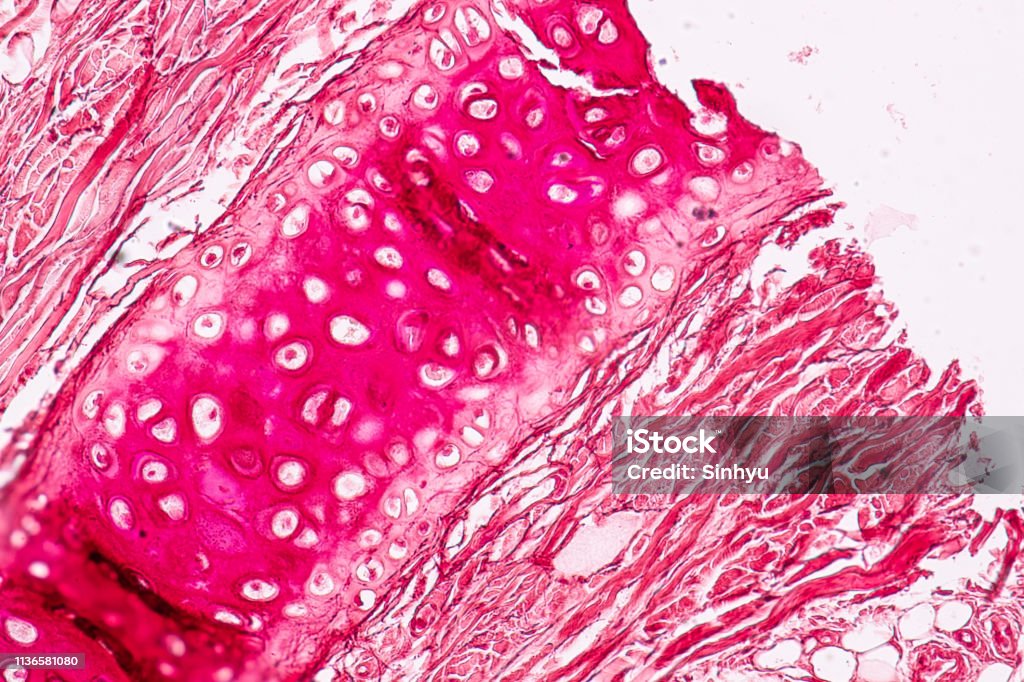 Education anatomy and Histological sample Elastic cartilage Tisue under the microscope. Larynx Stock Photo