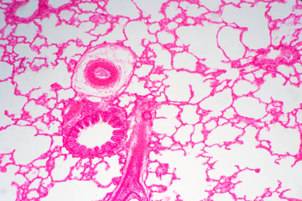 istock Human lung tissue under microscope view. Lungs are the primary organs of the respiratory system in humans and many other animals 1136629325