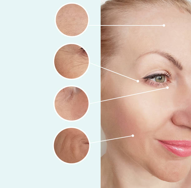 istock woman wrinkles   after  procedures 1136646223