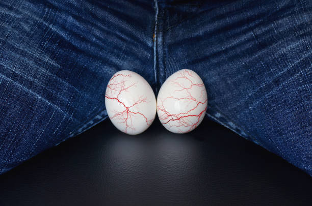 White eggs - a symbol of man's balls. varicocele - male disease leading to infertility in men. the concept of risk urological diseases. Varicose veins on the testicles. varicocele - male disease leading to infertility in men. the concept of risk urological diseases. White eggs - a symbol of man's balls. Varicose veins on the testicles. testis stock pictures, royalty-free photos & images