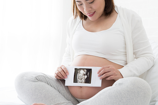 Pregnant women holding four-dimensional ultrasound images on hand, Techniques and abdominal applications, Prenatal diagnosis concept, Asian pregnancy woman model