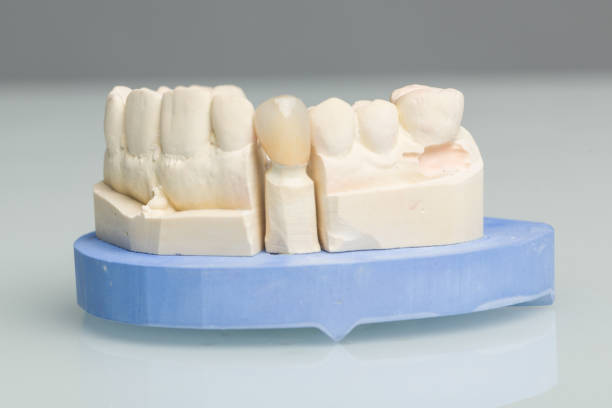 istock Dental imprint with artificial dentition in a dental laboratory ready for use 1136771796