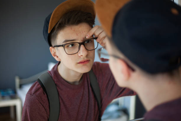 istock Teenage boy popping pimples 1136788810
