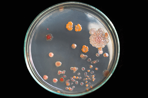 Top view soil microorganisms Nutrient agar in plate on black background.