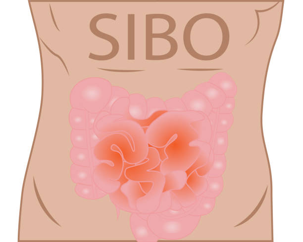 illustrazioni stock, clip art, cartoni animati e icone di tendenza di piccola crescita batterica intestinale - sibo - alimentary