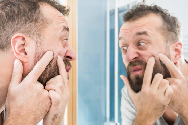 istock Man looking at pimples on his face 1136910016