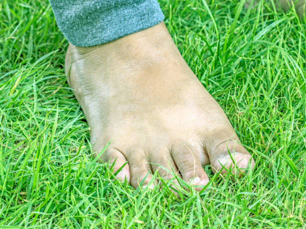 istock Man's feet in the lawn 1136949585