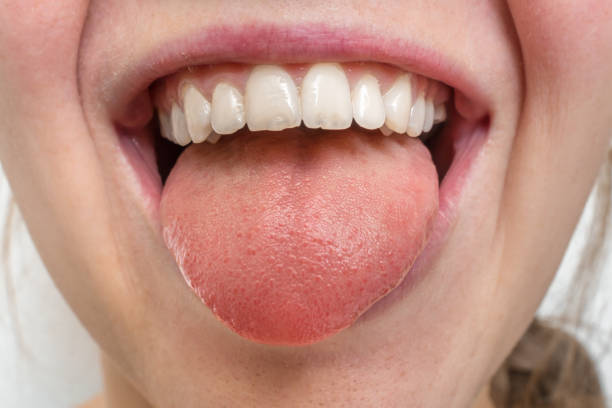 istock Woman with open mouth showing tongue 1137028941