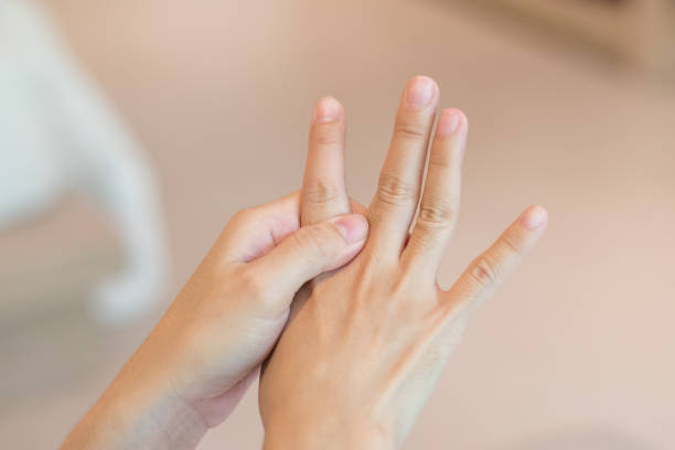 sobreusar los problemas de la mano. mano de mujer con la mancha roja o dedos como sufre de síndrome del túnel carpiano. los síntomas de hormigueo, entumecimiento, debilidad o dolor en los dedos y la muñeca. - human finger fotografías e imágenes de stock