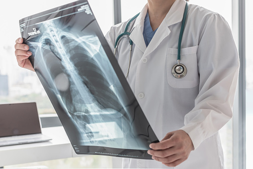 Médico con radiografía de tórax radiológico para diagnóstico médico sobre la salud del paciente en el asma, enfermedad pulmonar y enfermedad del cáncer óseo photo