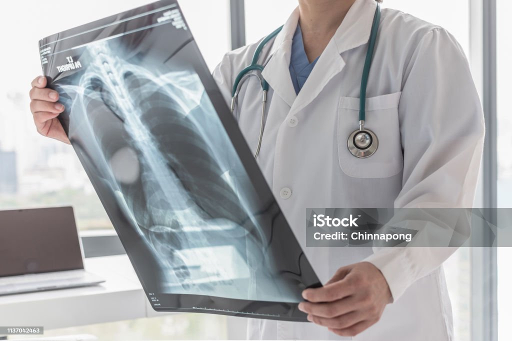 Doctor with radiological chest x-ray film for medical diagnosis on patient's health on asthma, lung disease and bone cancer illness Lung Stock Photo