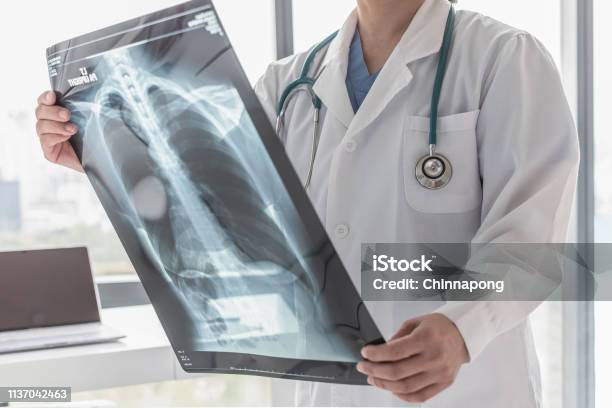 Doctor With Radiological Chest Xray Film For Medical Diagnosis On Patients Health On Asthma Lung Disease And Bone Cancer Illness Stock Photo - Download Image Now