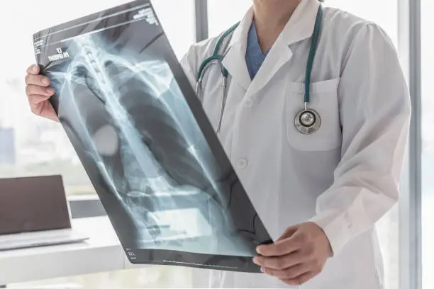 Photo of Doctor with radiological chest x-ray film for medical diagnosis on patient's health on asthma, lung disease and bone cancer illness